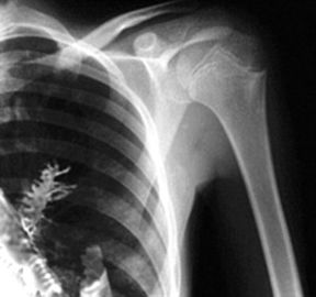 Medyczna folia rentgenowska Agfa / Fuji, przenośna folia do drukarek laserowych do radiografii