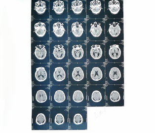 Degradowalna biała baza PET Materiał X-ray Papierowa folia medyczna